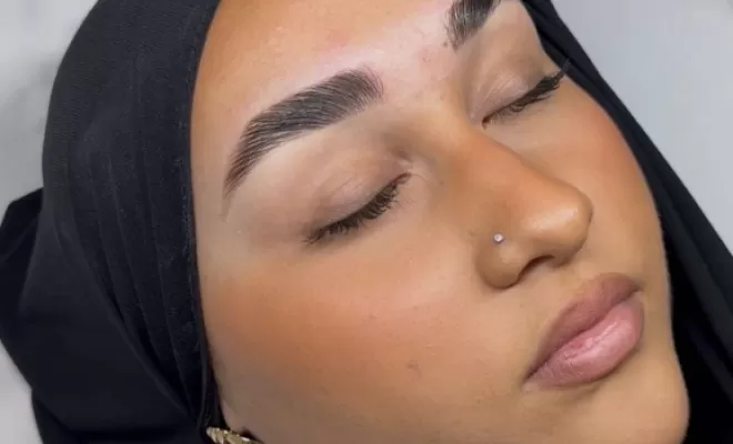 Brow lift 